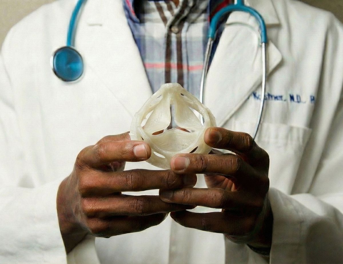 Physician holding a prosthetic heart valve